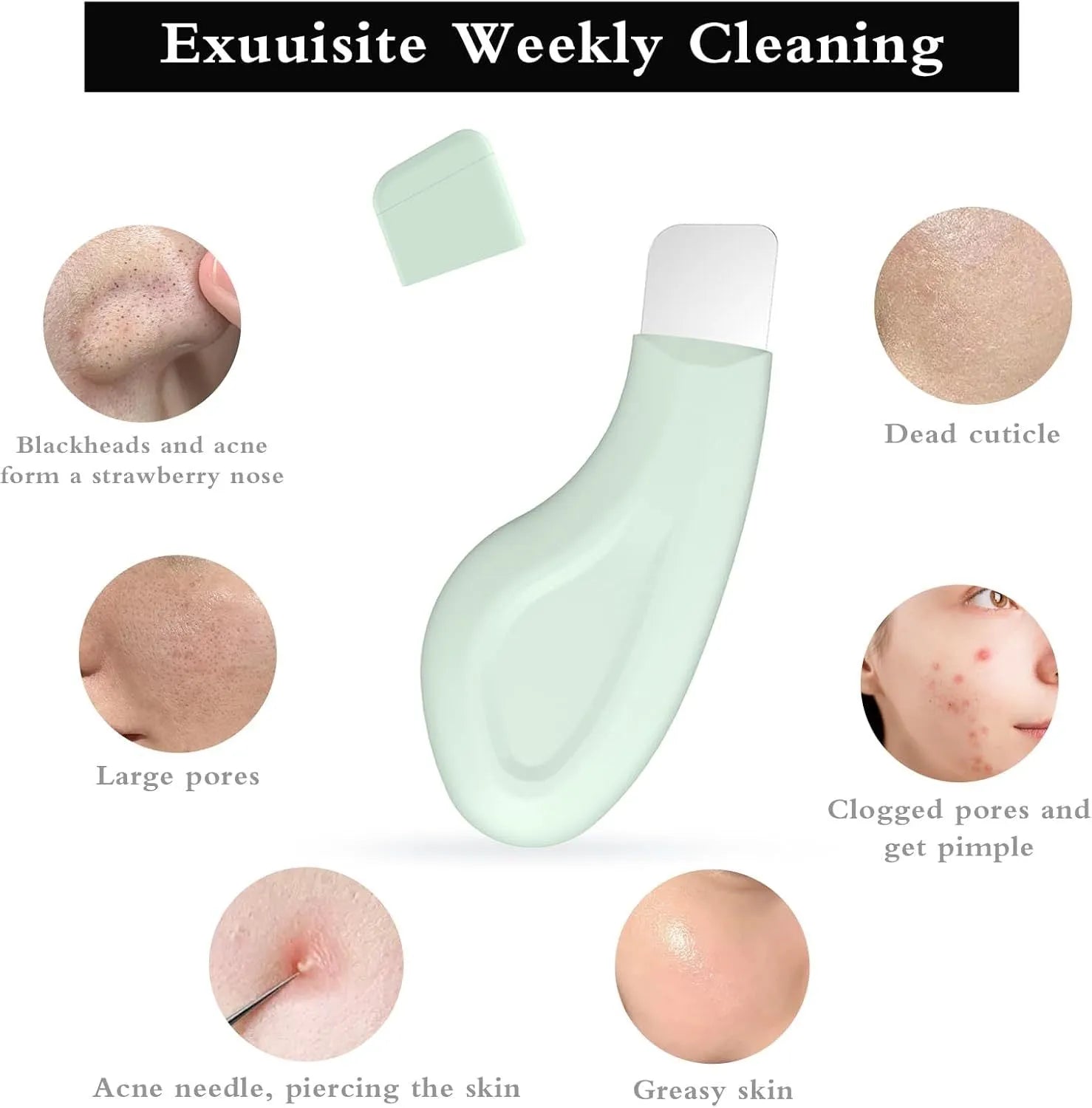Stainless steel blackhead scraper tool with a non-slip handle for facial pore cleansing