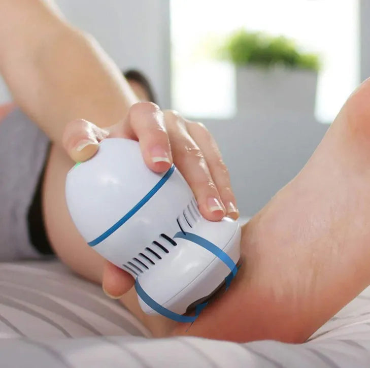 Beige and white electric foot file grinder with USB cable and two diamond grinding heads on a plain background