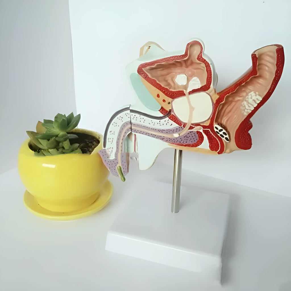 Male anatomical urinary system model showing internal reproductive pathology conditions