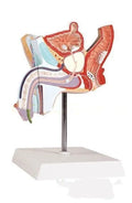 Male anatomical urinary system model showing internal reproductive pathology conditions