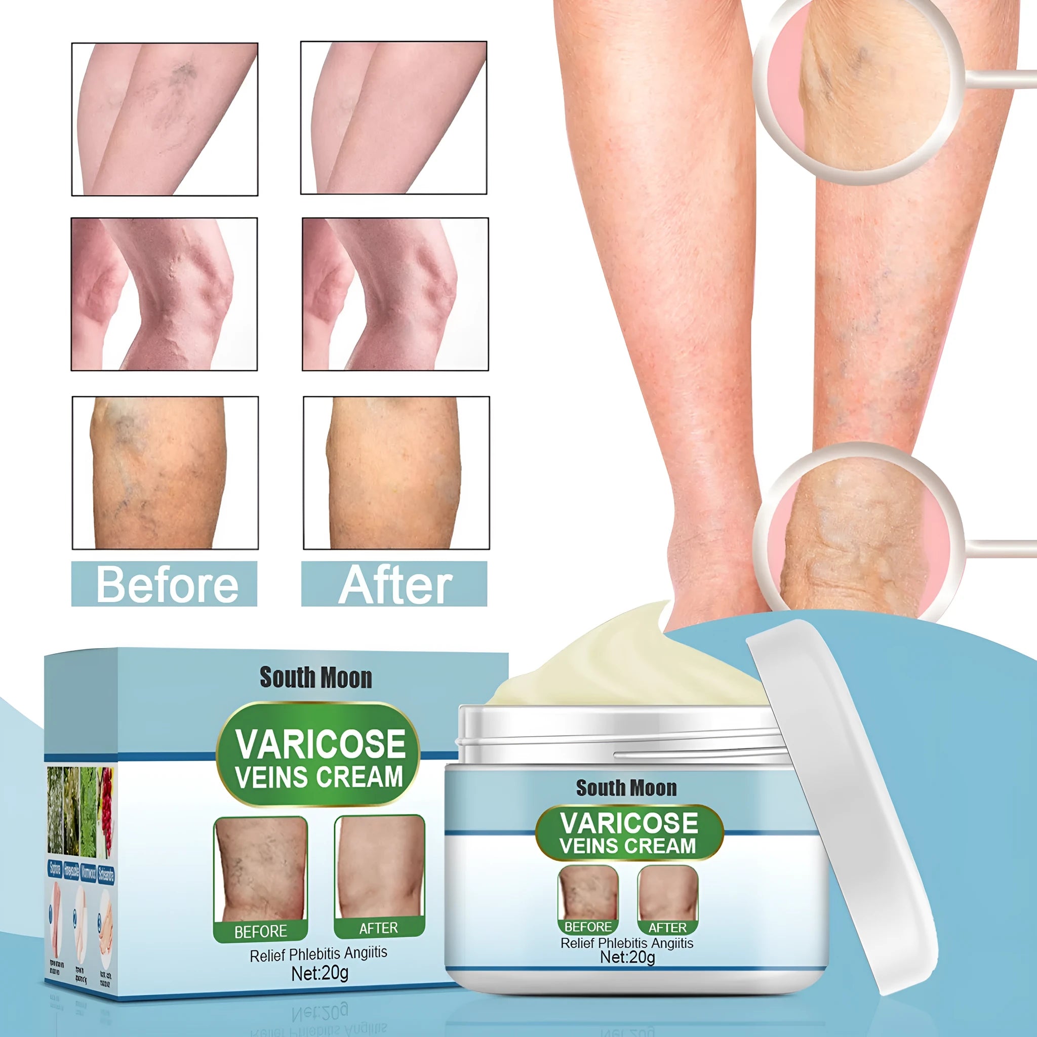20g tube of vein repair cream for varicose and thread veins