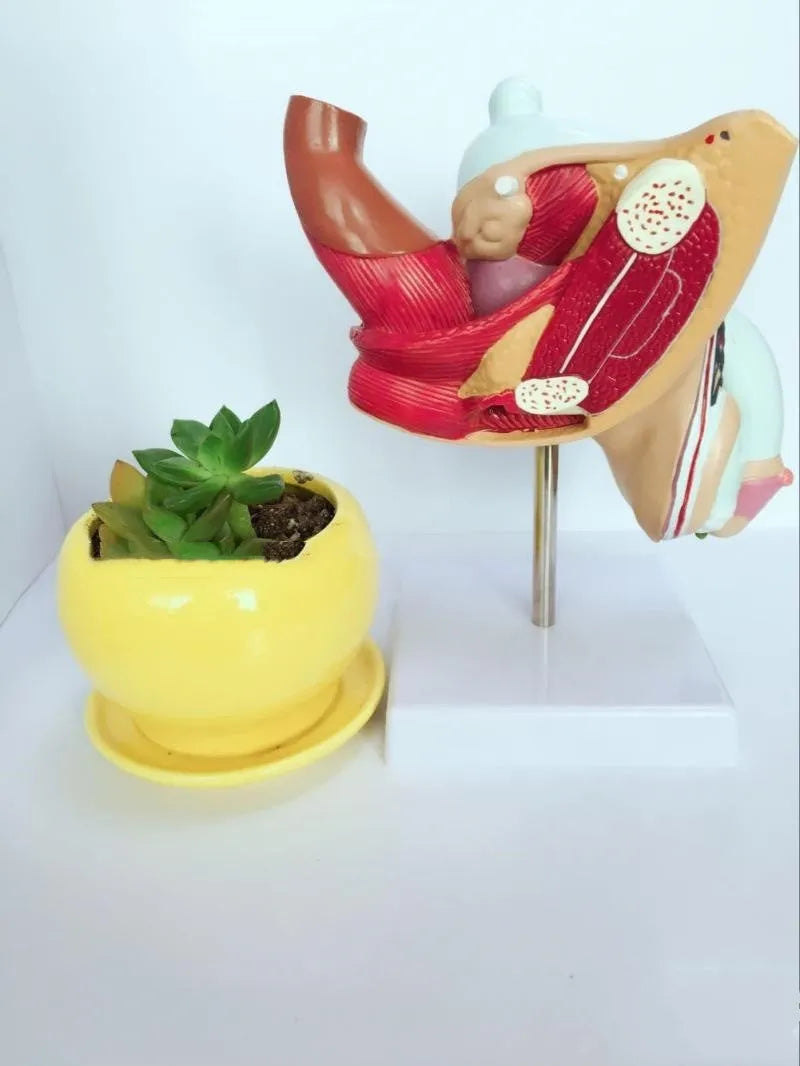 Male anatomical urinary system model showing internal reproductive pathology conditions