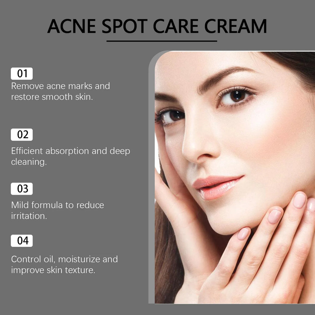 15g tube of acne cream with plant-based ingredients including mint leaf and tea tree oil
