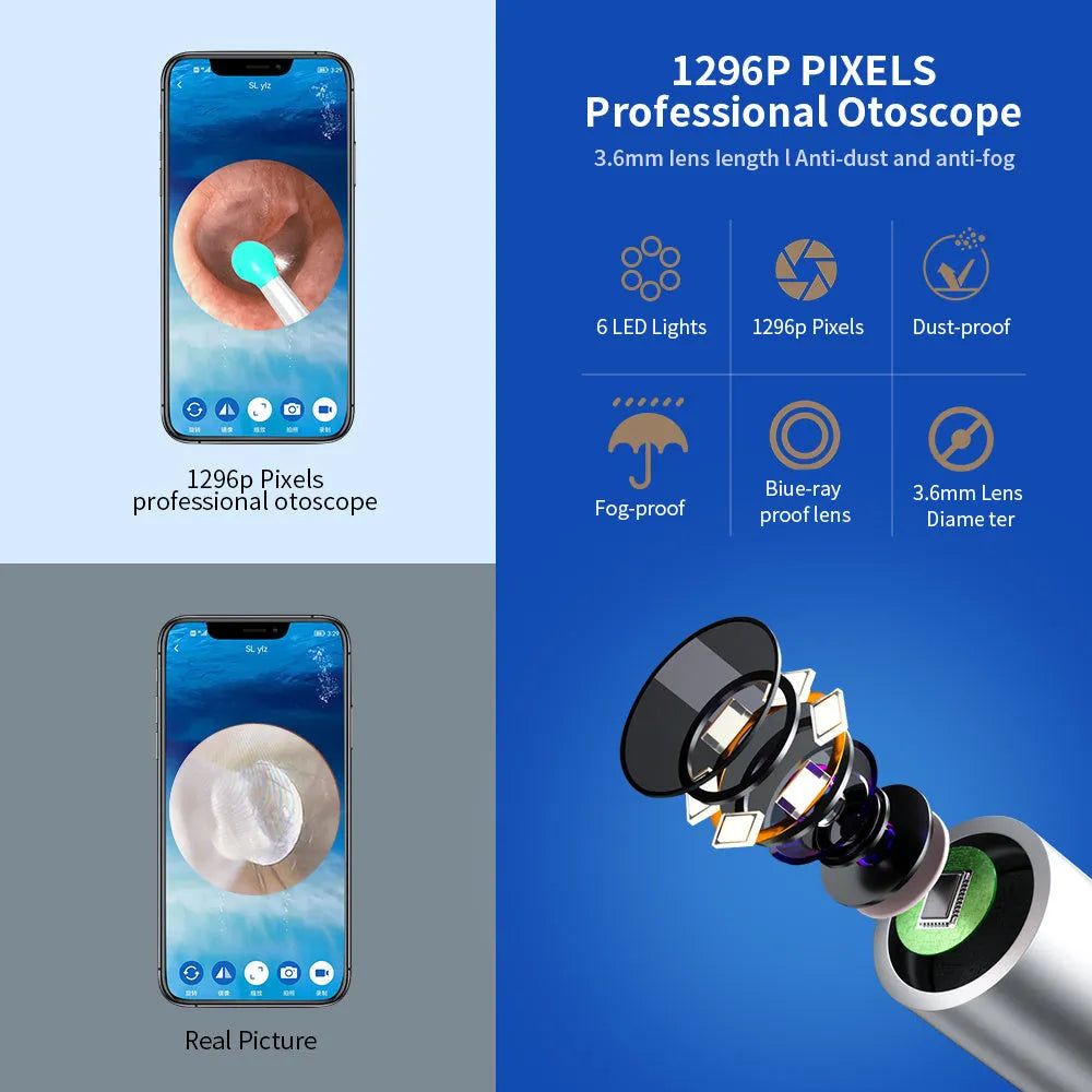 Black NE3 wireless otoscope ear cleaner with camera, Type-C cable, and four spoon heads on a white background.